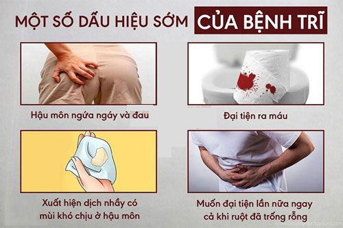 Biểu hiện của bệnh trĩ thường gặp nhất