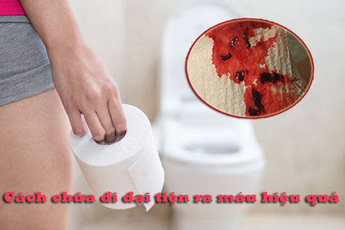 Cách chữa đi đại tiện ra máu hiệu quả