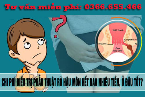 Chi phí phẫu thuật rò hậu môn hết bao nhiêu tiền?