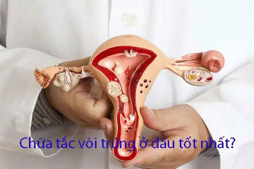 Địa chỉ chữa tắc vòi trứng ở đâu tốt nhất