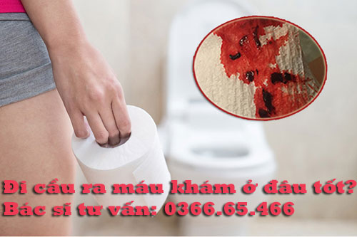 Đi cầu ra màu khám ở đâu tốt?