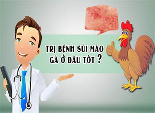 Top 11 địa chỉ khám chữa sùi mào gà ở đâu tốt nhất Hà Nội
