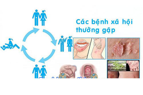 Top 10 địa chỉ xét nghiệm, khám bệnh xã hội ở đâu tốt nhất Hà Nội